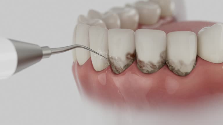 Trusted Teeth Cleaning And Checkup service in Greenwood, LA - Dentist Open Now